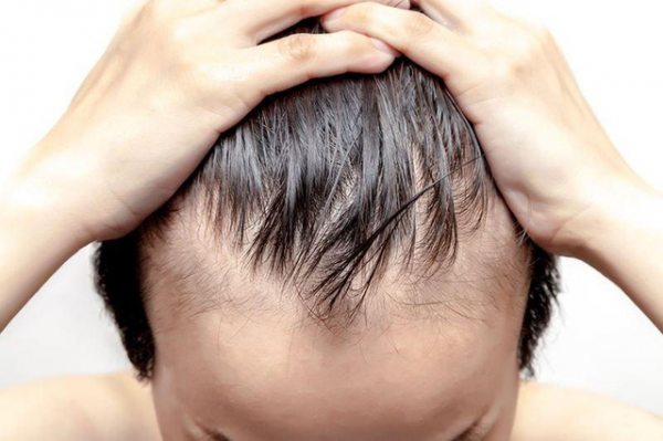 Tác dụng của tổ yến tăng cường phát triển sinh trưởng của tóc cho nam giới