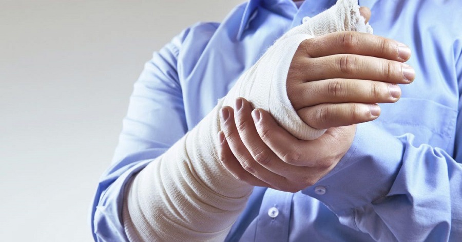 Gãy xương bó bột